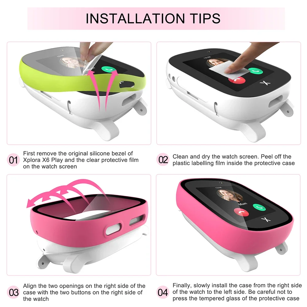 Casing untuk Xploar X6 Play Sm - Smart Watch Kids ulasan dan harga